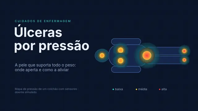 Capa da apresentação «Úlceras por pressão: prevenir»